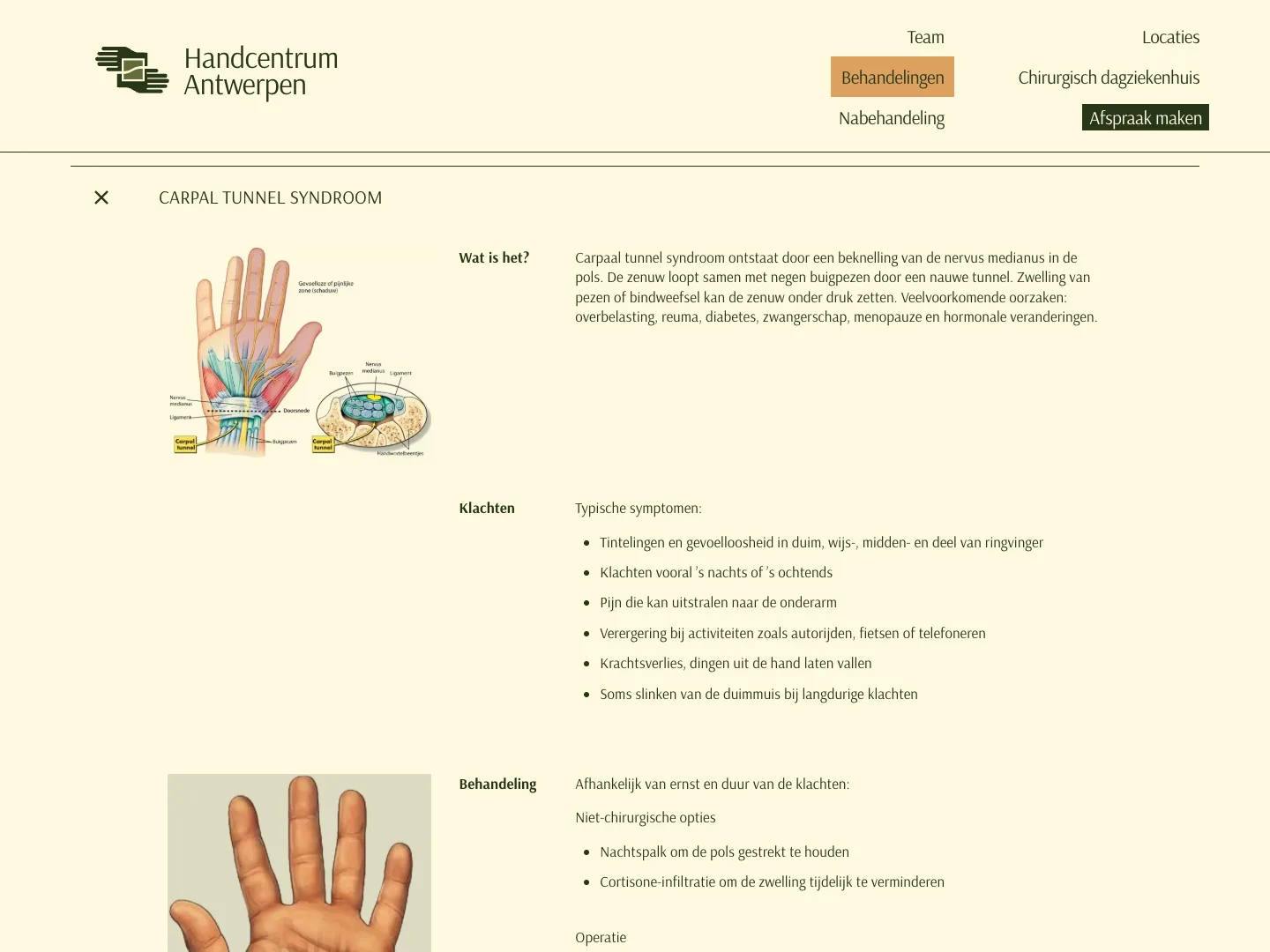Explanation of carpal tunnel syndrome with illustrations, symptoms and treatment